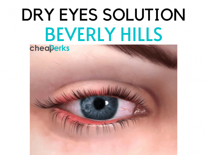 DRY EYES BEVERLY HILLS