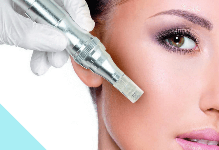 microneedling report