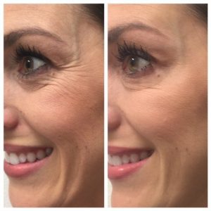 tns advanced serum before and after