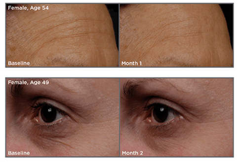 tns advanced serum before and after