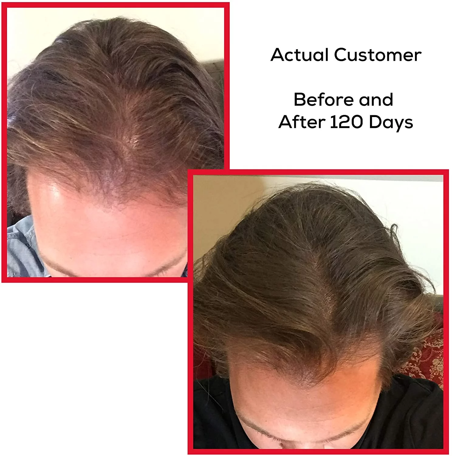 before and after