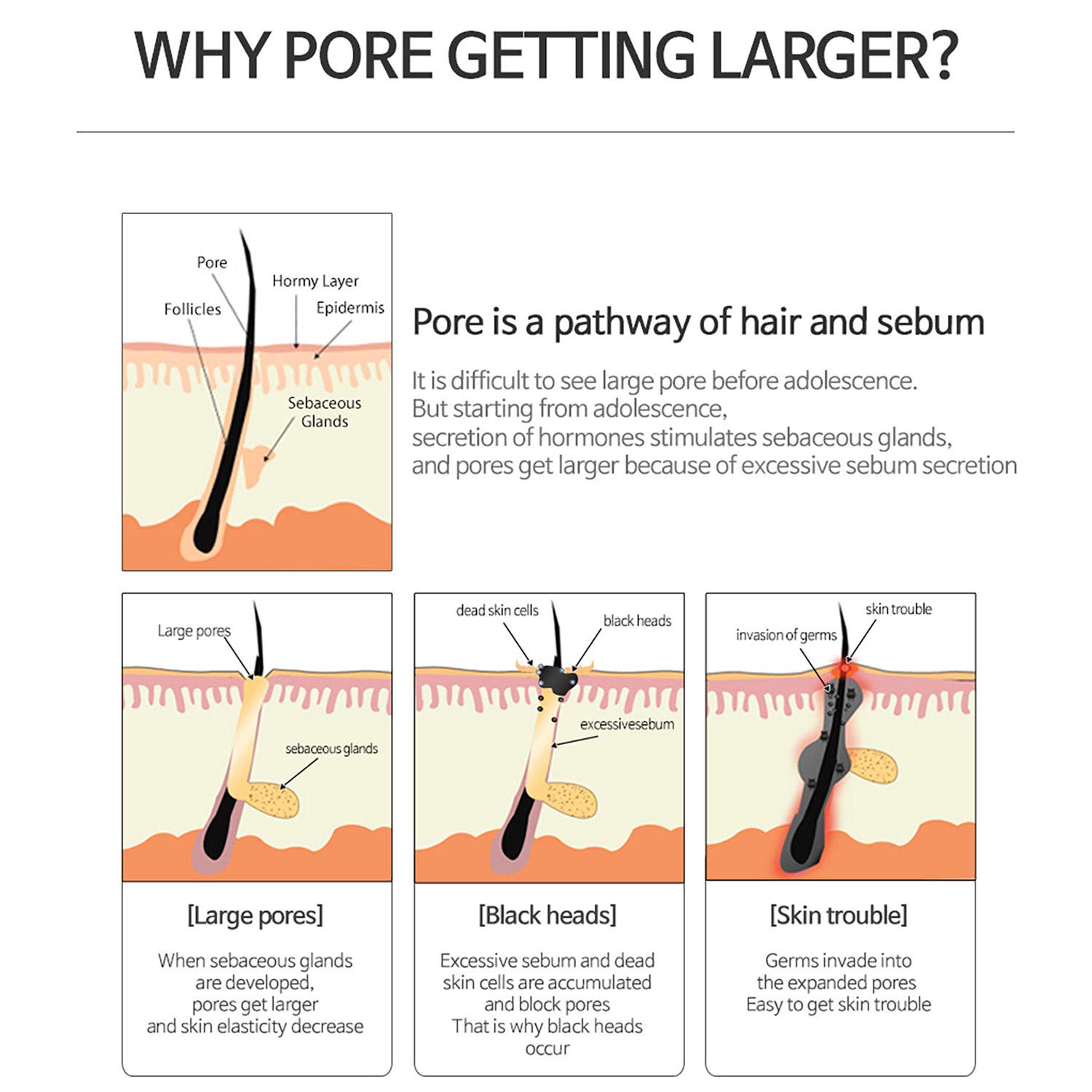 why plant base pore n