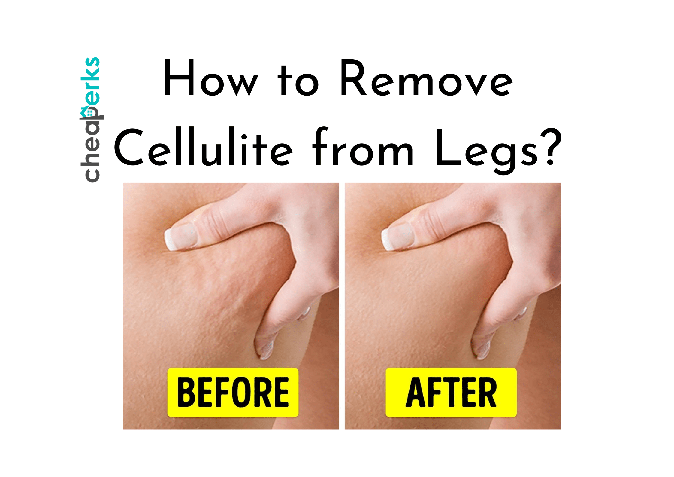 How To Remove Cellulite From Legs Easy Instant Methods ADDED 