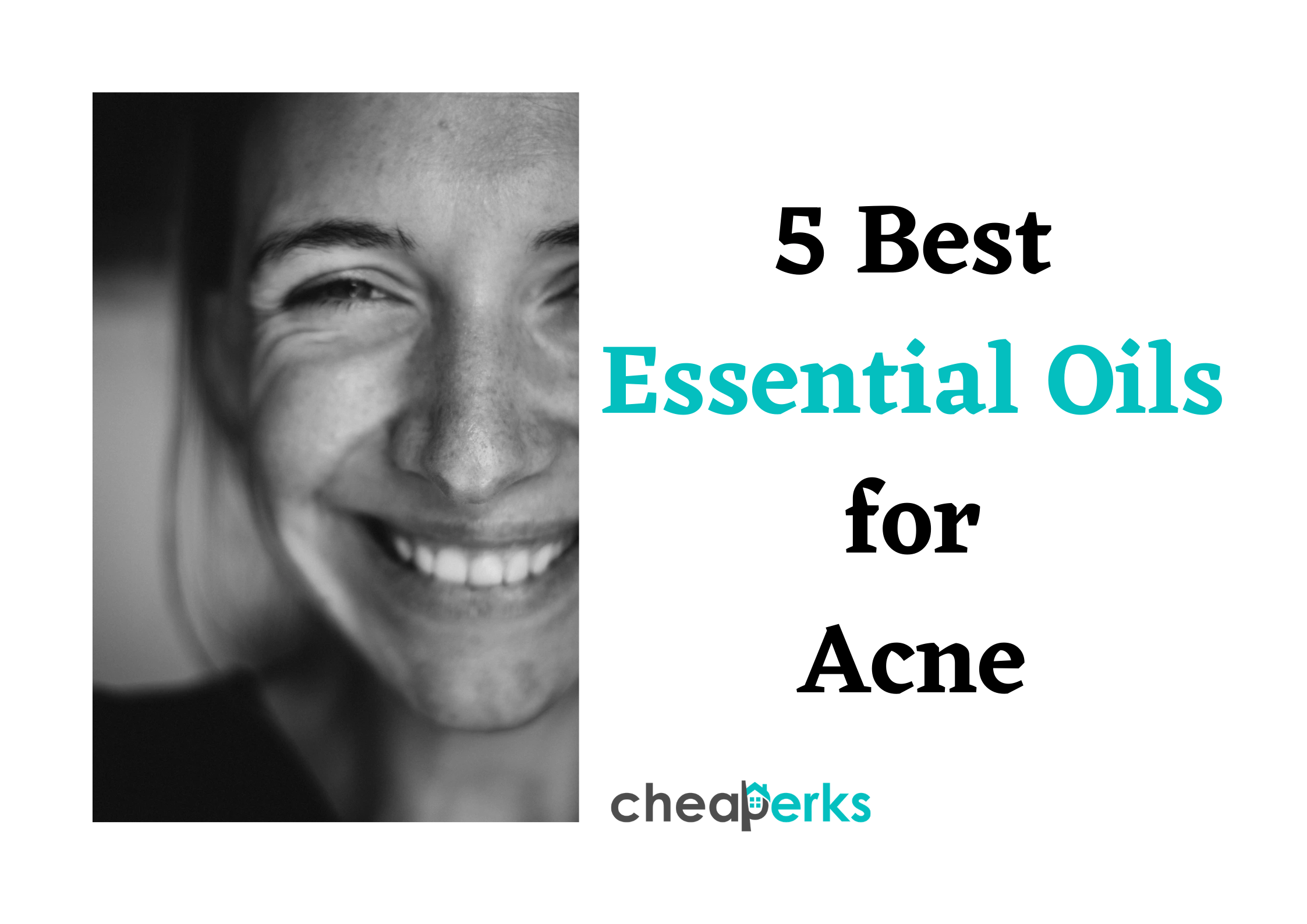 Best Essential Oils for Acne