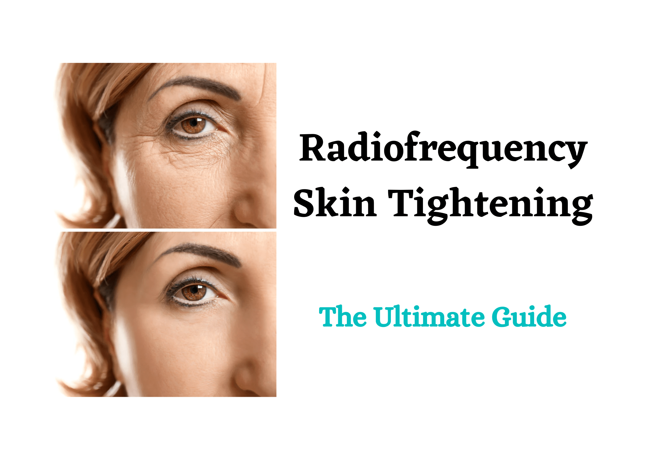 radiofrequency-skin-tightening-everything-you-need-to-know-about