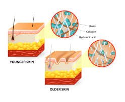 Radiofrequency Skin Tightening work