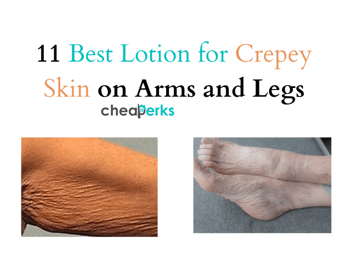 Best Lotion for Crepey Skin on Arms and Legs (1)