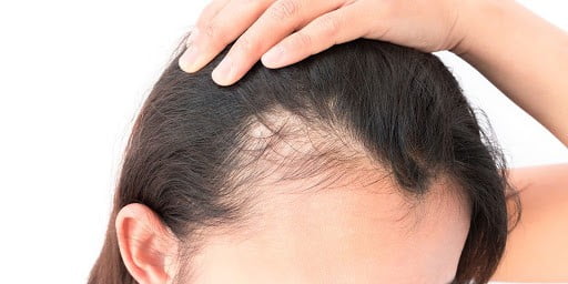 Does ScalpMed work for Alopecia