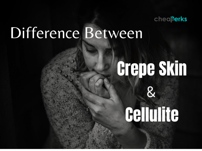 Difference Between Crepe Skin And Cellulite