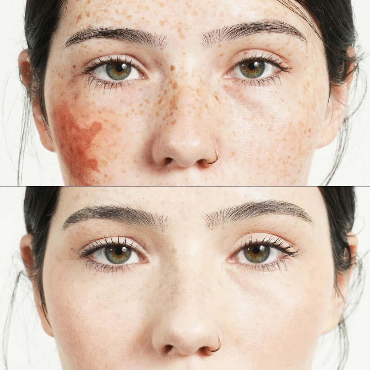 before after hide concealer