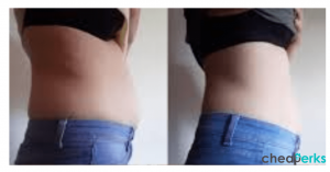 Bye Bye Bloat Before and After Pictures
